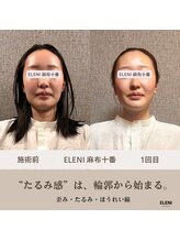 エレーニ 麻布十番(ELENI)/20代後半の方からの感想です