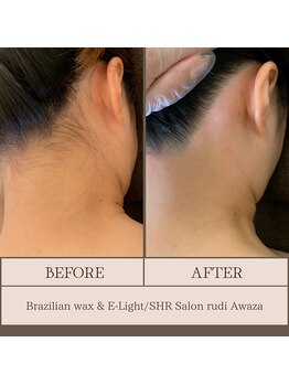 ルディ 阿波座店(rudi)/うなじ ワックス&光脱毛