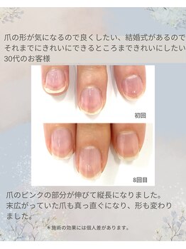最強ネイルケア