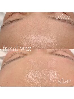 ルーズラッシュ リタアンドサン(Luu's LASH Rita&Sun)/フェイシャルワックス脱毛☆