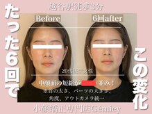 ジェイミー(Gemiey)/20代後半/面長でお悩みのお客様