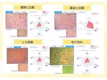 ベルスタイル(Bell style)の雰囲気（肌診断機器を使って悩みの原因から改善までお伝え◎）