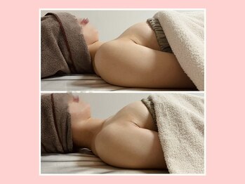 イッツソウ(It's so...)/ビフォーアフター写真