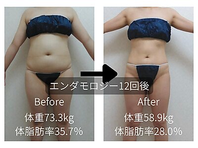 熊本市でエンダモロジーが人気のエステサロン｜ホットペッパービューティー