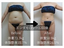 ピカイチ 上通店(pikAicHi)