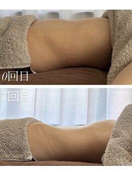 ポエマ(POEMA)の写真/スッキリしないのが当たり前な方へ!腸もみで繰り返す不調の根本にアプローチ★理想の私へ♪