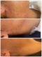 エクラ(Eclat)の写真/お肌化粧ノリ抜群のツヤ肌へ導き、透明感UPを目指すケアで素肌に自信!☆