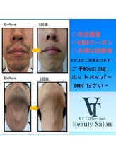 アット(ATTO)/青髭卒業！！！