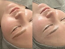 ムーンサン(Moon sun)/1回の変化