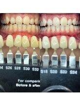 トウキョウスワーズ 池袋店(TOKYO SWRS)/#ホワイトニング #池袋 #渋谷