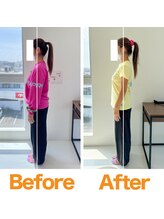 整体院ひなた 宮崎院/産後骨盤-9cm!!反り腰改善！宮崎