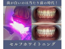 グリッター ショウナン(glitter.SHONAN)の雰囲気（別人レベルに変身!!ハーブの力で肌悩み0へ★）