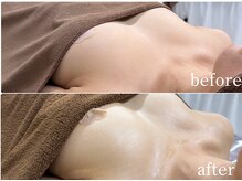 ルナリア ルクス 志木南口駅前店/ハリ　弾力アップ