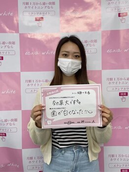 エクシアホワイトニング 稲沢店/お客様の口コミをご紹介☆
