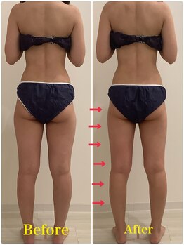 スペチアーレ 夙川/ハイパーナイフでスッキリ脚長