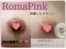 ジュノ 諫早店(JUNO)の雰囲気（【ローマピンク】長崎初導入！施術は1回で完了♪限定70%OFF！！）