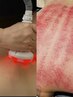 ★驚愕の効果実感★ 筋膜リリース※スリムムーブ３部位＋全身リンパ90分