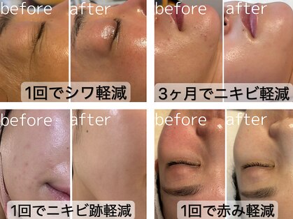 ラ ルーチェ 南青山(La Luce)の写真