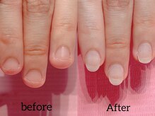 ネイル クロス ラニ 所沢店(Nail×Lani)/もう隠さない深爪矯正／所沢