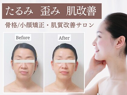 ミレア(Milea)の写真