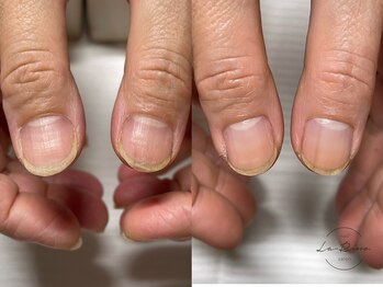 ラ リノ(La-Rino.)/爪トラブル育成