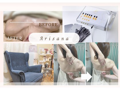 アリサナ(Arisana)の写真