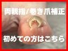 【巻き爪・陥入爪ケア】あんなに巻いてた爪が…広がった！を実感したい方♪
