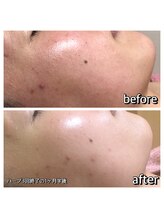 パーソナルエステティックサロン リボーン(ReBorn)/