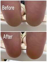 ティアラ(Tiara)/【Foot】角質ケア