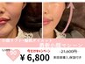 【11(水)15(日)限定】¥21,600→¥6,800【小顔リフト,ダイエット】小顔