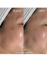 プリンセスローズ 焼津店(Princess Rose)/ムートン泡エステ