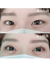 フローラビューティ(Flora Beauty)/まつげ美容液効果【岡山】