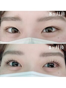 フローラビューティ(Flora Beauty)/まつげ美容液効果【岡山】