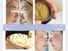 デュマージュ オブ サンシャインビューティー(DeuMarge of sunshinebeauty)