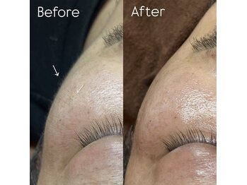 リリィ(Lilly.)/Men’s FaceWAX