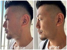 ボヌールデソワ(Bonheur de Soi)/髭脱毛