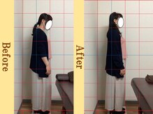 岡崎メディカル整体 アンド ゴールデンケア/20代～慢性的な腰痛（整体）