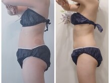 ニコルビー(Nicole Bee)/浮腫まない身体に！