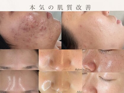 ルブラン(Lu'Bulan)の写真