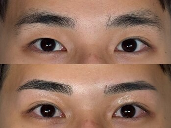 ハク 谷町(HAK.)/メンズ眉毛ワックスBefore/After