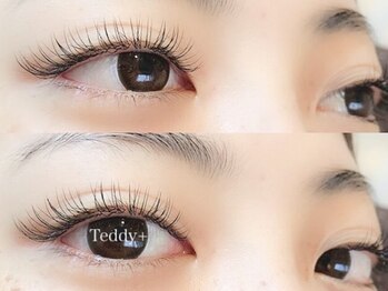 テディプラス(Teddy+)/