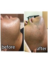 パーソナルエステティックサロン リボーン(ReBorn)/