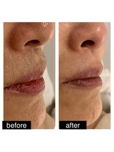 エスライン 円山店(Sline)/マスクで隠れて疎かに！？