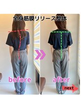 ライトワーク 西新宿店/体の歪み矯正