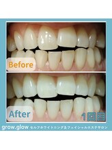 グロウ グロウ(grow.glow)/