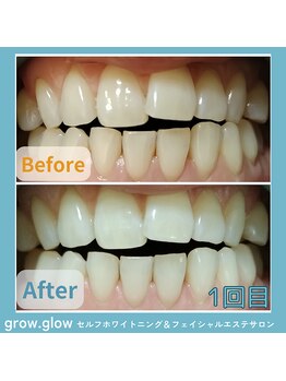 グロウ グロウ(grow.glow)/