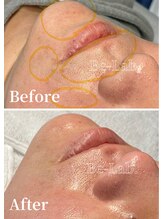 ビーラボ(Be-Lab.)/フェイシャルワックスも大人気☆