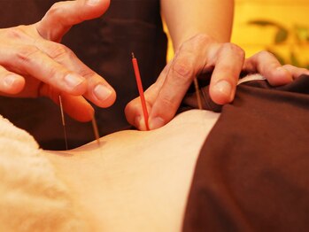 くるみハウス/鍼灸施術