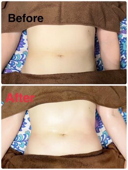 アジアンリラクゼーション ヴィラ 宮城野幸町店(asian relaxation villa)/Sora限定女性お腹集中コース