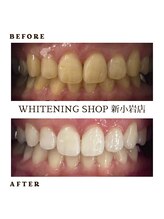 ホワイトニングショップ 新小岩店/歯科提携　ホワイトニング専門店
